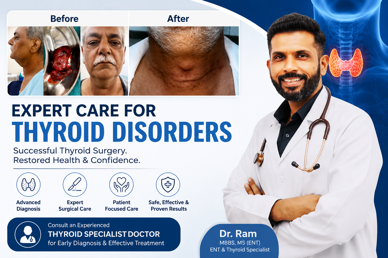 Thyroid Specialist Doctor for Early Thyroid Disorder Care