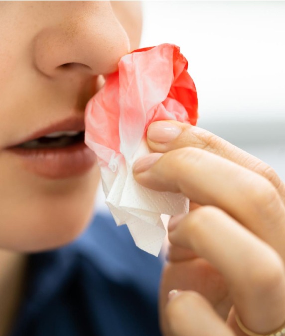 Causes of Nose Bleeds